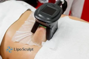 Are The Results From Aqualyx Permanent? 4 Compare Aqualyx Hanworth to other fat reduction treatments.