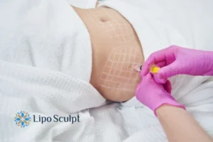 Are The Results From Aqualyx Permanent? 1 Do you want to know how long Aqualyx Hanworth results last?