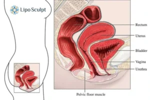 Treatment For A Leaky Bladder 2 How EM Chair treatment Hanworth can help Leaky bladder issues. Read more now!