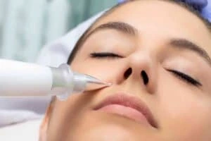 Best Actinic Keratoses Removal 3 Actinic keratoses Hanworth solutions - book in today!