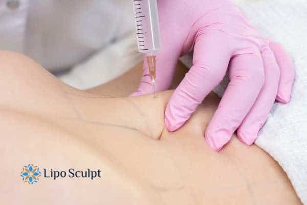 Aqualyx for Muffin Tops: What to Know Before Fat-Dissolving Injections 4 Are there risks Hanworth?